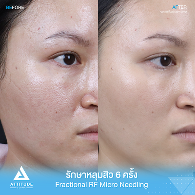 เมนูของร้าน Attitude Clinic  ห้วยขวาง