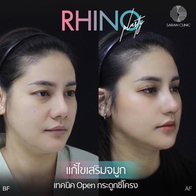 หมอศรัณย์ (คลินิกศัลยกรรมนายแพทย์ศรัณย์)