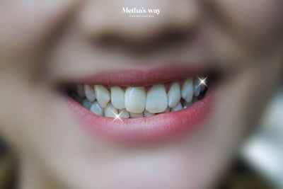 บริการหรือผลลัพธ์ที่ได้