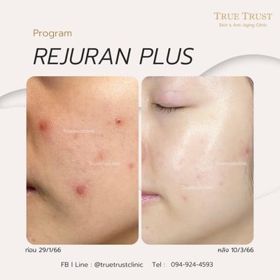 TrueTrust Clinic รามอินทรา