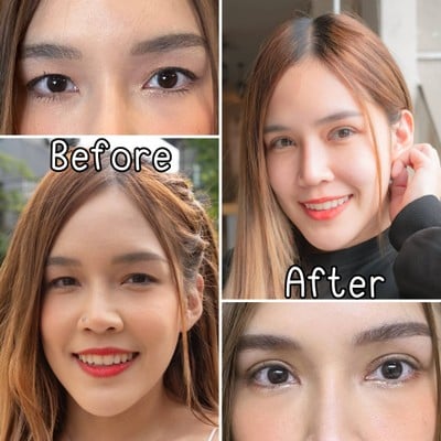 ตาสองชั้นและชั้นตาที่หวานขึ้น
