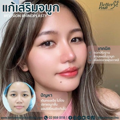 Better Me Clinic by Dr. Chanya