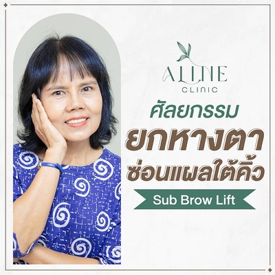 บริการหรือผลลัพธ์ที่ได้