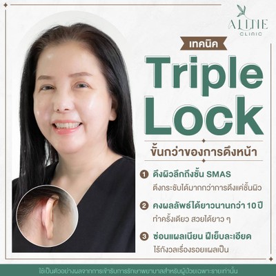 บริการหรือผลลัพธ์ที่ได้