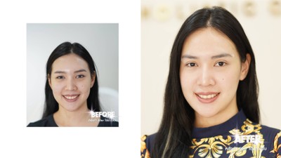 SARUNCARE CLINIC ปิ่นเกล้า