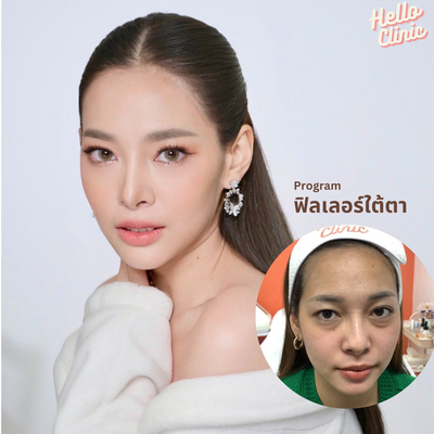 Hello Clinic ลาดพร้าว