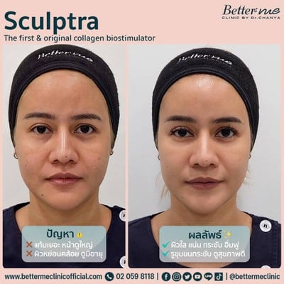 Better Me Clinic by Dr. Chanya