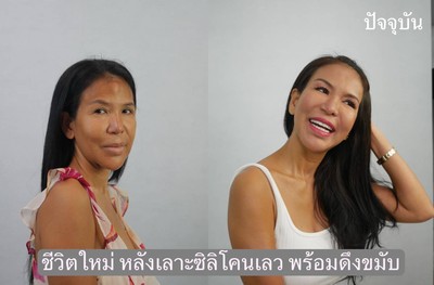 เลาะซิลิโคนเหลว