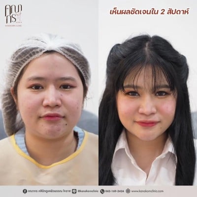 บริการหรือผลลัพธ์ที่ได้