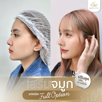 เมนูของร้าน Esme Clinic เอสเมคลินิก โคราช