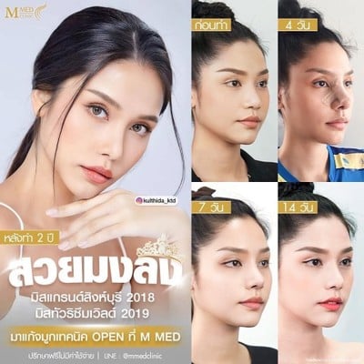 M Med Clinic สาขา นครปฐม นครปฐม