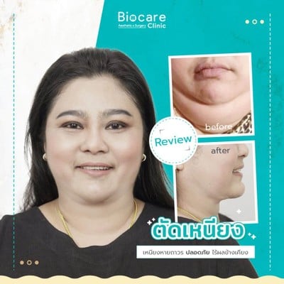 Biocare Clinic
