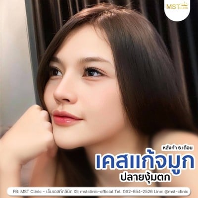 MST Clinic   อุบลราชธานี
