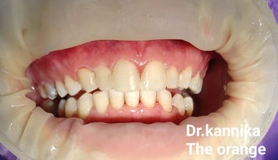 The Orange Dental Clinic  บางใหญ่