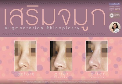 บริการหรือผลลัพธ์ที่ได้