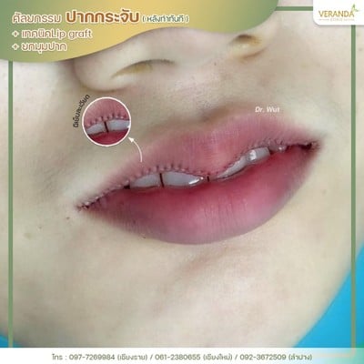 Veranda Clinic  เชียงราย