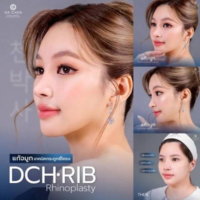 Dr.CHEN Surgery Hospital International Center  รามคำแหง 160