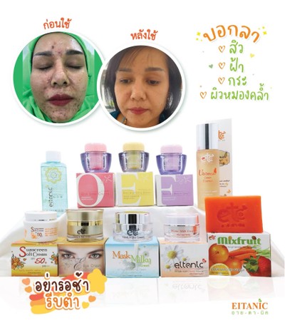 อื่นๆ