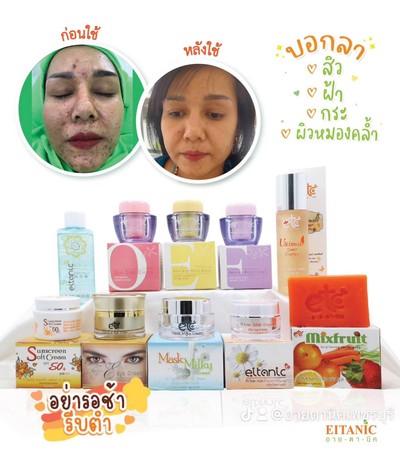 อื่นๆ