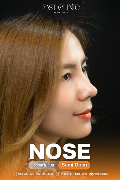 อีสต์ คลินิก - East Clinic เชียงใหม่ คลองชลประทาน