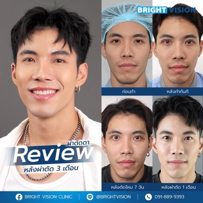 Bright Vision Clinic