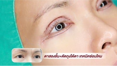 Prinx Clinic
