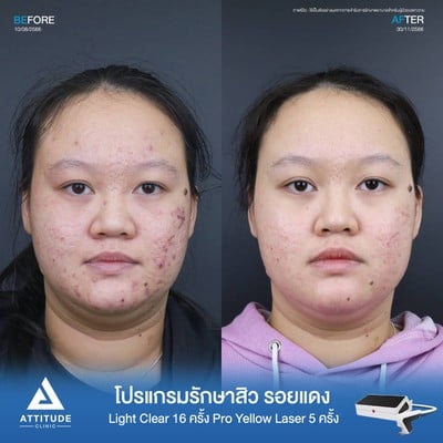 Attitude Clinic ลำปาง