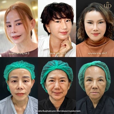 UD CLINIC รัชดา สุทธิสาร ทางออก MRT ประตู 4