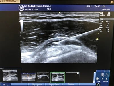 Rehab Care Clinic เมืองทองธานี