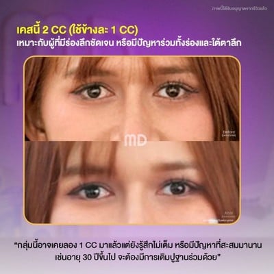 Md Clinic เอ็มดีคลินิก อุดรธานี