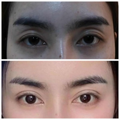 แกรนด์มาสเตอร์ คลินิก