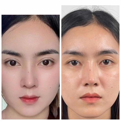 แกรนด์มาสเตอร์ คลินิก