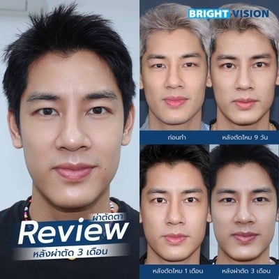 Bright Vision Clinic