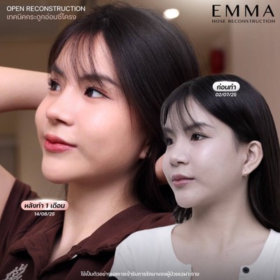 EMMA Clinic ลาดพร้าว