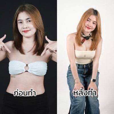 AM international Hospital (AMARA LIPOSUCTION CENTER) รัชโยธิน, ราชพฤกษ์ AM international Hospital (AMARA LIPOSUCTION CENTER) รัชโยธิน, ราชพฤกษ์