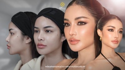 APi Clinic Surgery & Wellness เสริมจมูกเทคนิคเกาหลี by หมอต้น AF