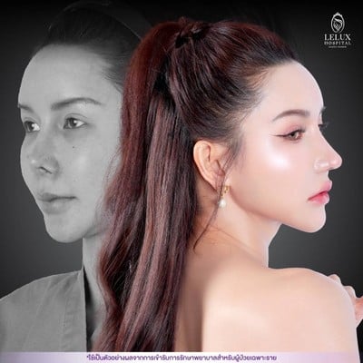 โรงพยาบาลเลอลักษณ์  (LELUX Hospital)