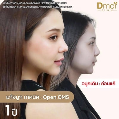 Dmor Clinic รัชดาภิเษก