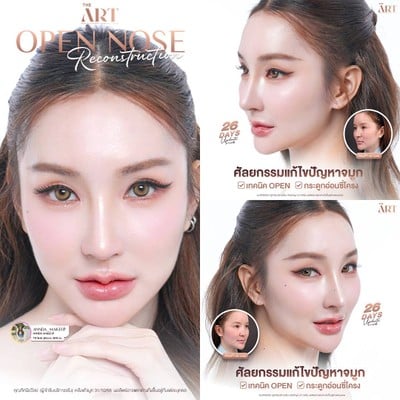 The Art Plastic Surgery Hospital