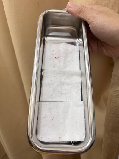 สิวที่กดออก