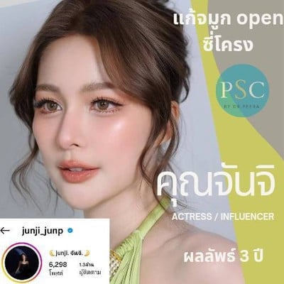 ศูนย์ศัลยกรรมตกแต่ง ผิวหนัง และ เลเซอร์ พีเอสซี