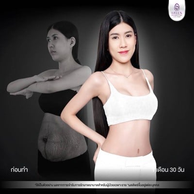 โรงพยาบาลเลอลักษณ์  (LELUX Hospital)