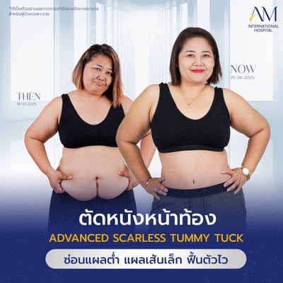 AM international Hospital (AMARA LIPOSUCTION CENTER) รัชโยธิน, ราชพฤกษ์