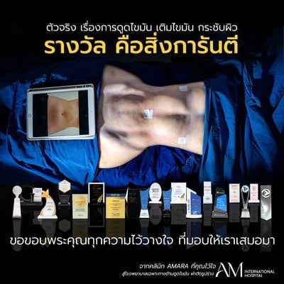 AM international Hospital (AMARA LIPOSUCTION CENTER) รัชโยธิน, ราชพฤกษ์