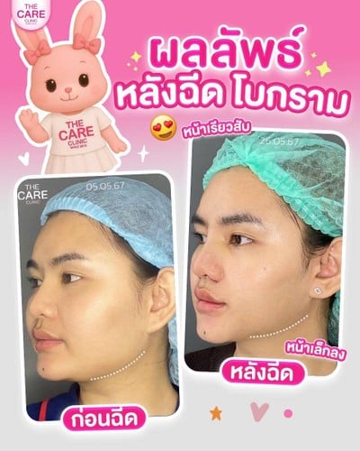 เดอะแคร์คลินิก สาขามหาสารคาม