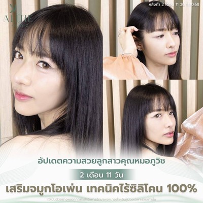 บริการหรือผลลัพธ์ที่ได้