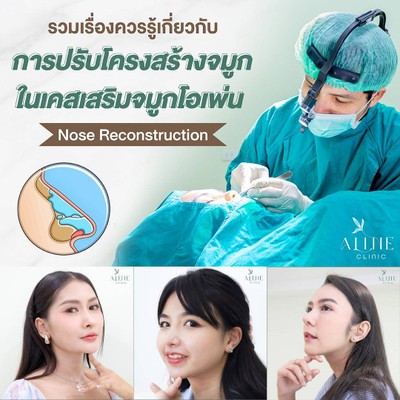 บริการหรือผลลัพธ์ที่ได้