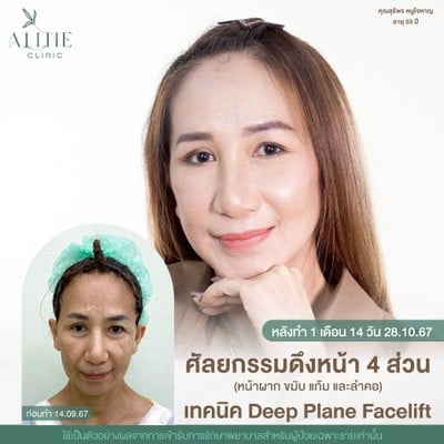 บริการหรือผลลัพธ์ที่ได้