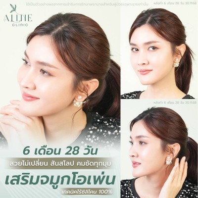 บริการหรือผลลัพธ์ที่ได้
