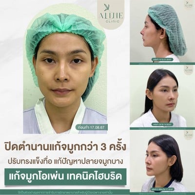 บริการหรือผลลัพธ์ที่ได้